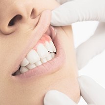 teeth gums checkup