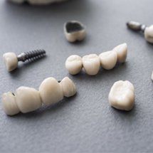 A series of dental implants and restorations.