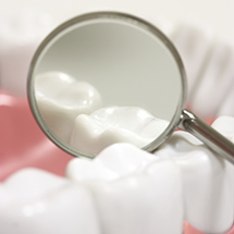 Dental mirror showing teeth